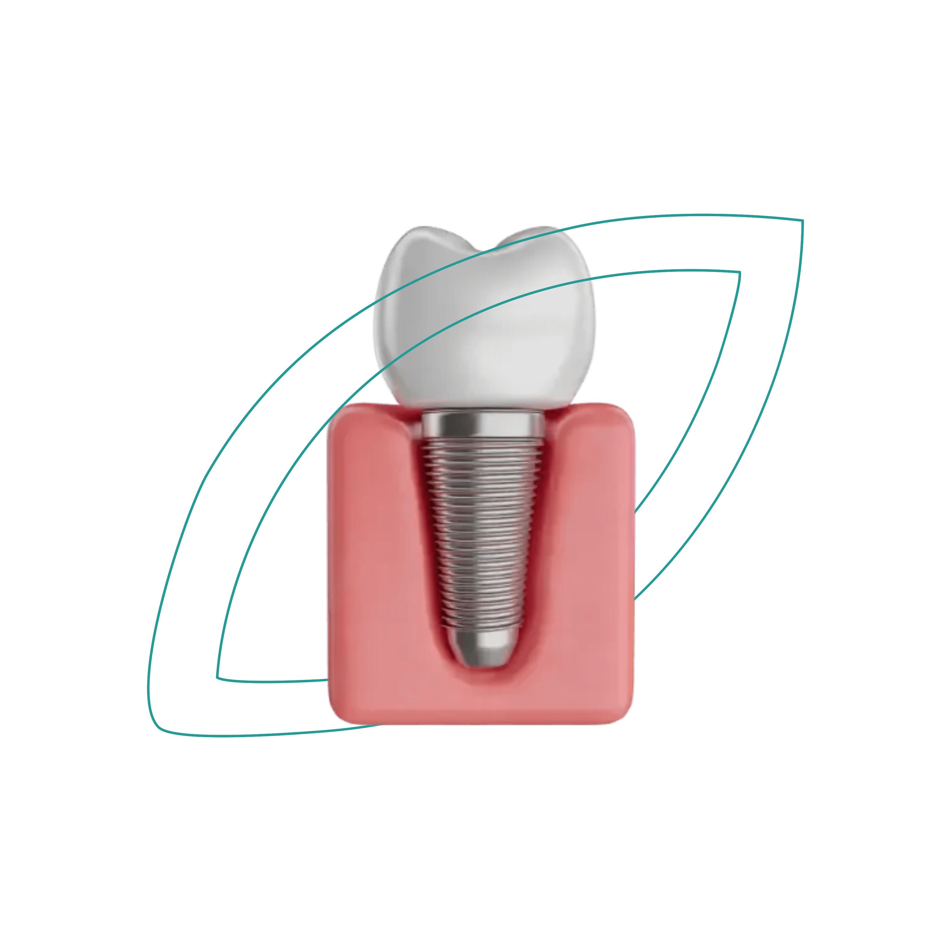 Servicio de Implantes y Regeneración Ósea